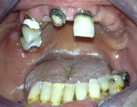 Estetska stomatologija-prije 4